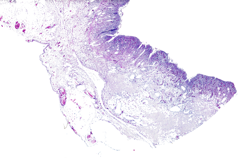Histopathology Histopathology